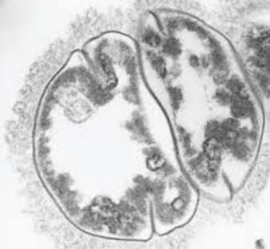   Lentisphaerae
